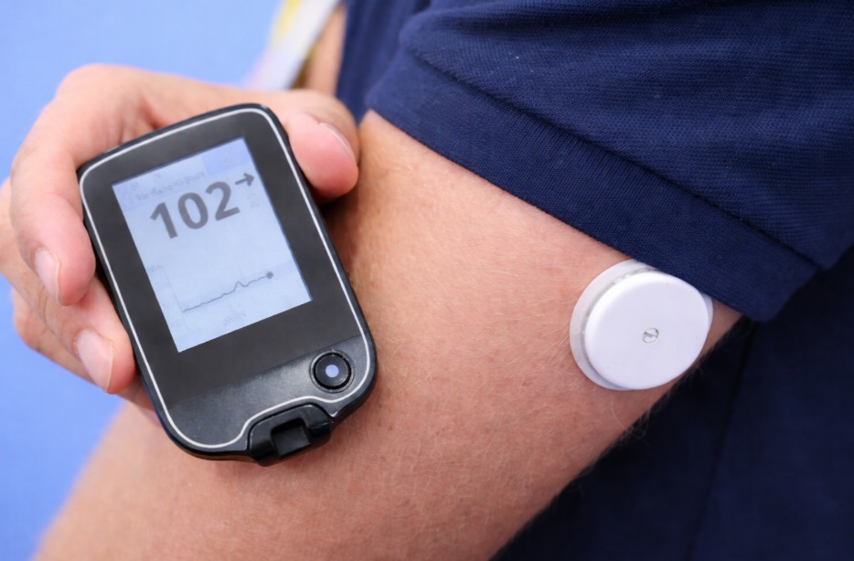 Saúde de Penha realiza levantamento complementar para futura aquisição de sensores de glicose para DM1