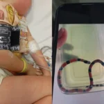Menina de 4 anos sofre choque anafilático após irmão confundir cobra-coral com minhoca em Itajaí